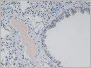 product-image-AAA21005_IHC5.jpg