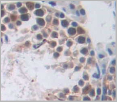 product-image-AAA21011_IHC6.jpg