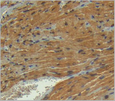 product-image-AAA21013_IHC5.jpg