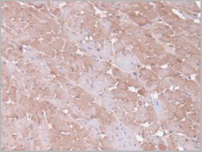 product-image-AAA21014_IHC3.jpg