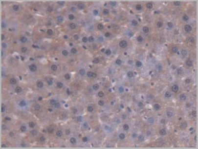 product-image-AAA21014_IHC4.jpg
