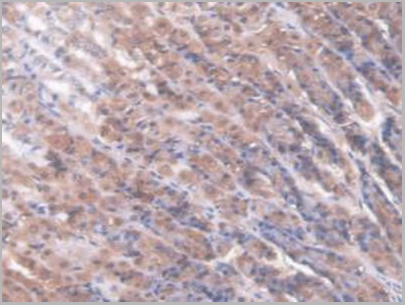 product-image-AAA21014_IHC5.jpg