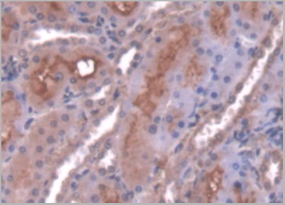 product-image-AAA21014_IHC6.jpg