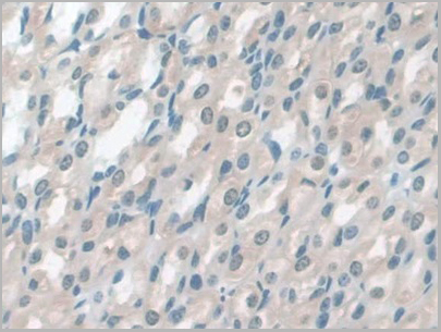 product-image-AAA21016_IHC6.jpg