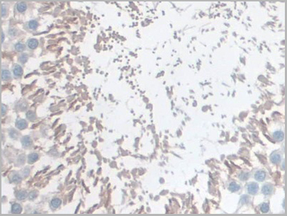 product-image-AAA21016_IHC7.jpg
