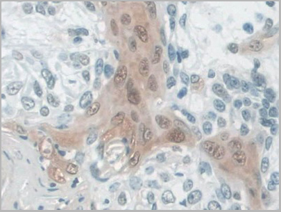 product-image-AAA21028_IHC3.jpg