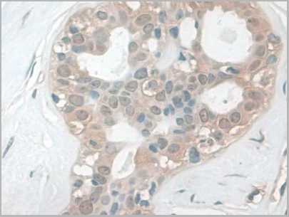 product-image-AAA21028_IHC4.png