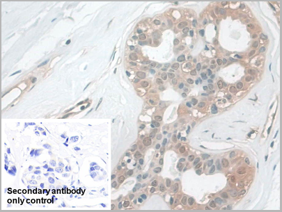 product-image-AAA21028_IHC5.png