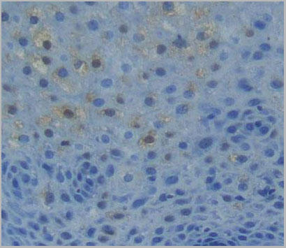 product-image-AAA21042_IHC3.jpg