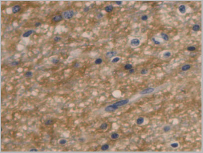 product-image-AAA21051_IHC6.jpg