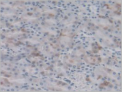 product-image-AAA21053_IHC5.jpg