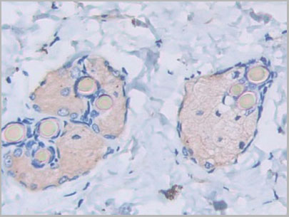 product-image-AAA21053_IHC6.jpg