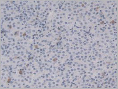 product-image-AAA21053_IHC7.jpg
