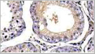 product-image-AAA21054_IHC3.jpg