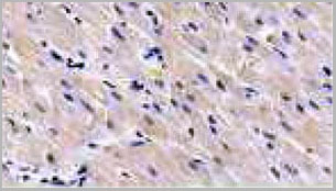 product-image-AAA21054_IHC4.jpg