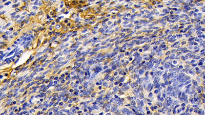 product-image-AAA21097_IHC2.jpg