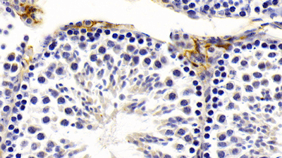 product-image-AAA21097_IHC3.jpg