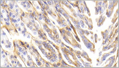product-image-AAA21097_IHC4.jpg