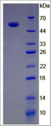 product-image-AAA21102_SDS_PAGE5.jpg