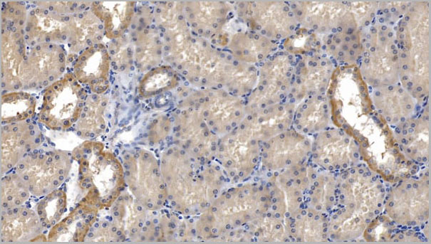 product-image-AAA21160_IHC4.jpg