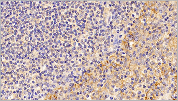 product-image-AAA21160_IHC5.jpg
