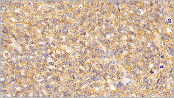 product-image-AAA21160_IHC6.jpg
