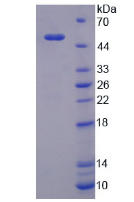 product-image-AAA21164_SDS_PAGE.png
