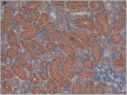product-image-AAA21176_IHC.jpg