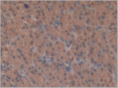 product-image-AAA21176_IHC2.jpg