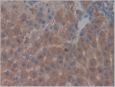 product-image-AAA21176_IHC3.jpg