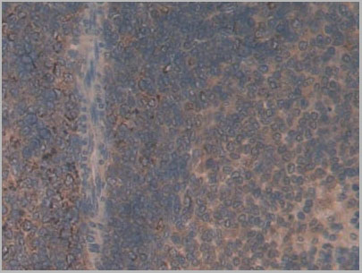 product-image-AAA21176_IHC4.jpg