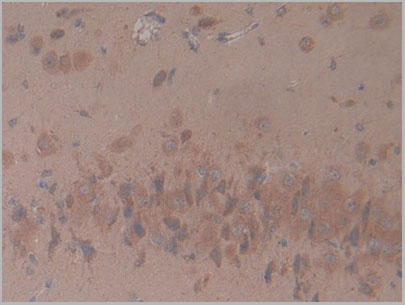 product-image-AAA21176_IHC5.jpg