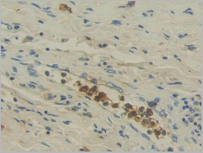 product-image-AAA21177_IHC2.jpg