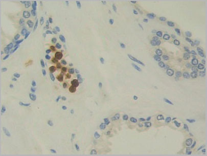 product-image-AAA21177_IHC3.jpg