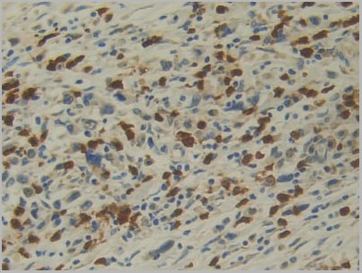 product-image-AAA21177_IHC4.jpg
