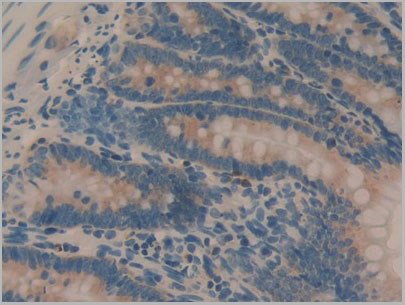 product-image-AAA21178_IHC2.jpg
