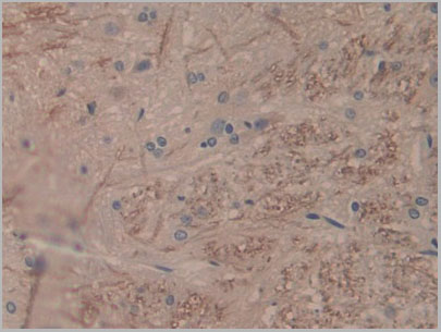 product-image-AAA21178_IHC3.jpg