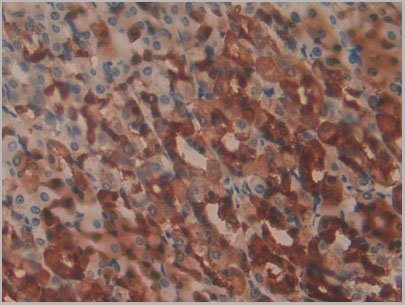 product-image-AAA21178_IHC5.jpg