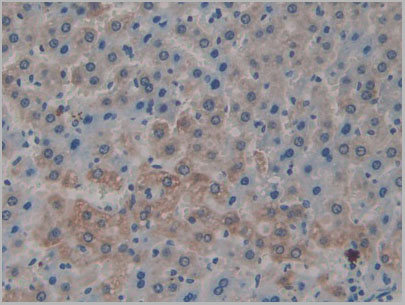 product-image-AAA21178_IHC6.jpg