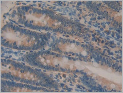 product-image-AAA21179_IHC2.jpg