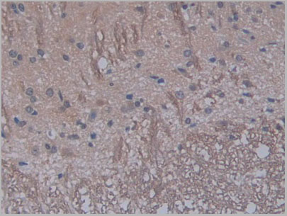 product-image-AAA21179_IHC3.jpg