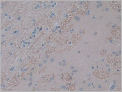 product-image-AAA21179_IHC4.jpg