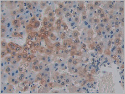 product-image-AAA21179_IHC6.jpg