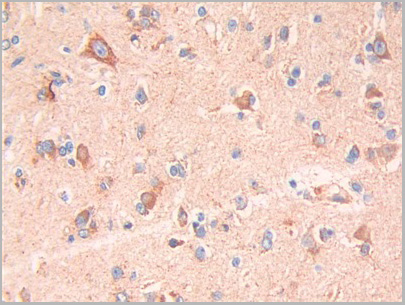 product-image-AAA21181_IHC.jpg