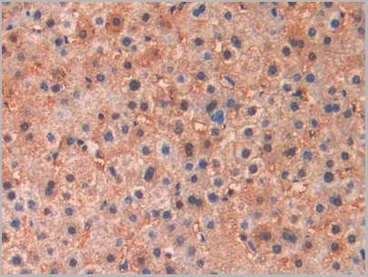 product-image-AAA21181_IHC2.jpg