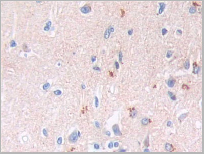 product-image-AAA21182_IHC4.jpg
