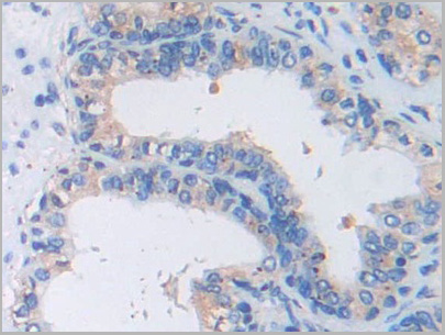 product-image-AAA21182_IHC5.jpg