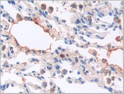 product-image-AAA21182_IHC6.jpg