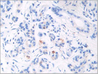 product-image-AAA21183_IHC.jpg