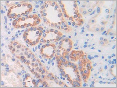 product-image-AAA21183_IHC3.jpg